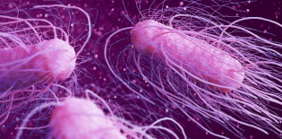 salmonella bacteria history